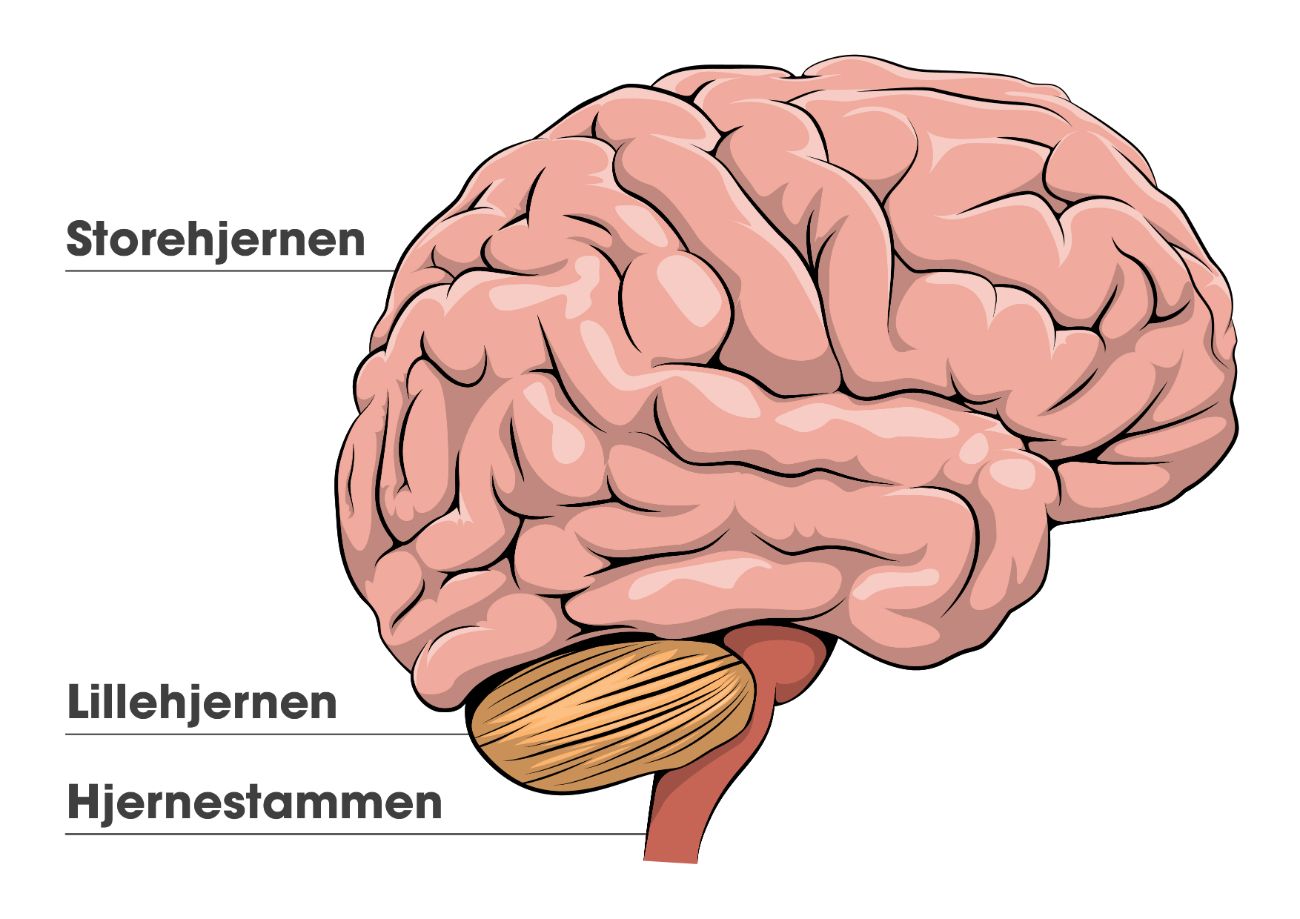 MSguiden Hjernestamme - multipel sclerose